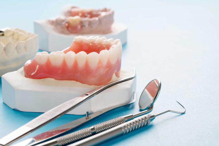 Dental Implants vs Dentures