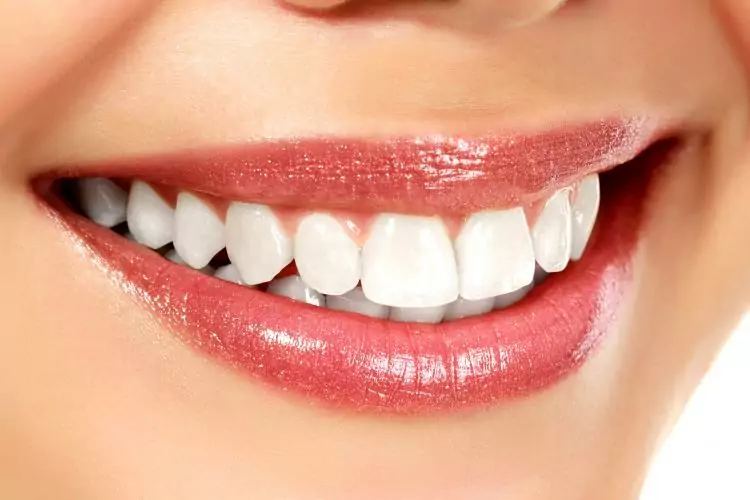 Tips for Keeping Your Teeth White