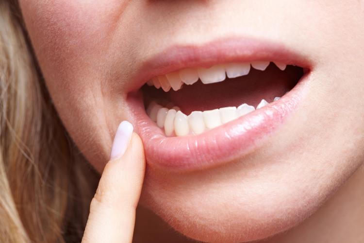 Is it Better to Replace a Tooth or Try Saving It?